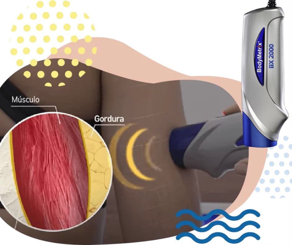 Avaliação BodyMetrix Ultrassom